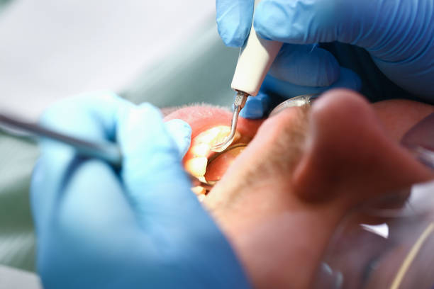 Best Chipped Tooth Repair Near Me  in Rockfish, NC