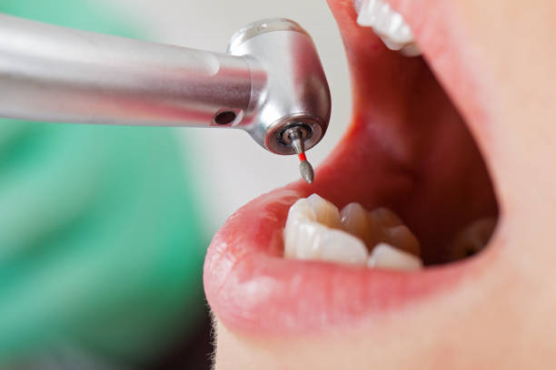 Best Emergency Gum Pain Relief  in Rockfish, NC